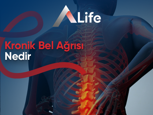 Kronik Bel Ağrısı Nedir ?